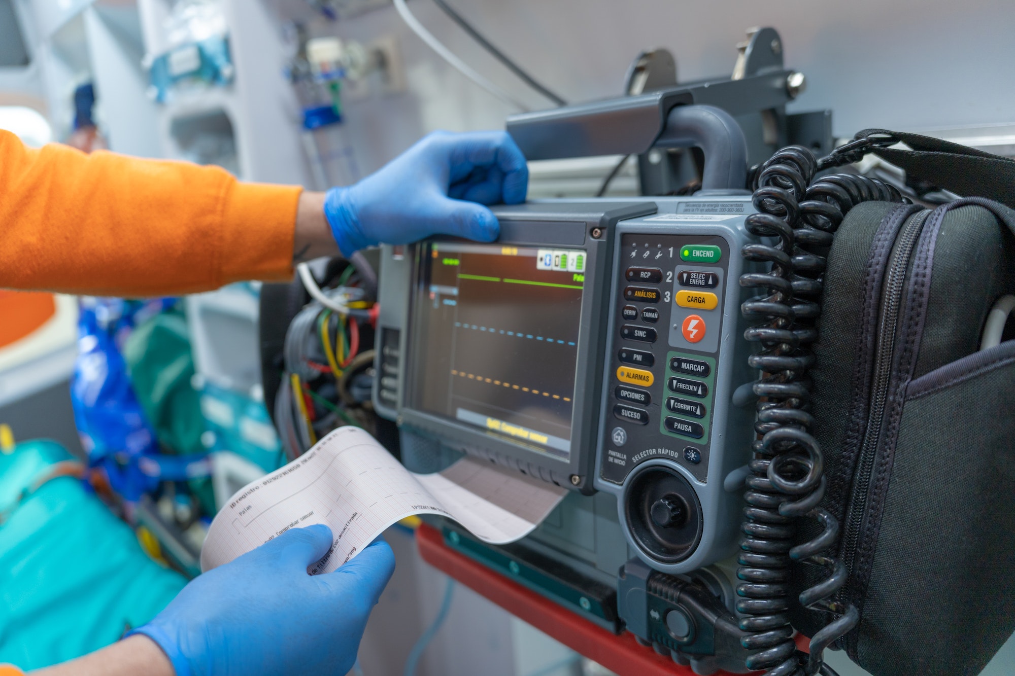 photo of a defibrillator monitor printing an electrocardiogram.